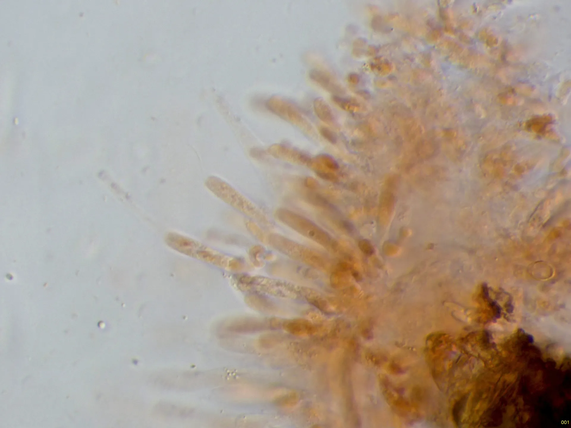 Microscopía de Peroneutypa scoparia - 8 - Himenio-001